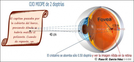 Obtención De Valores De Dioptría De Miopía Con Materiales Del Laboratorio De Óptica